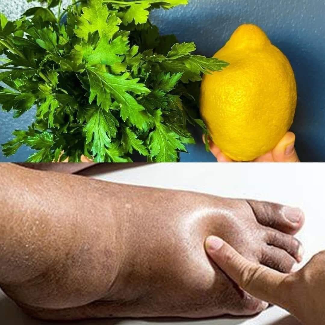 Natural Diuretics: Using Parsley and Lemon to Combat Water Retention