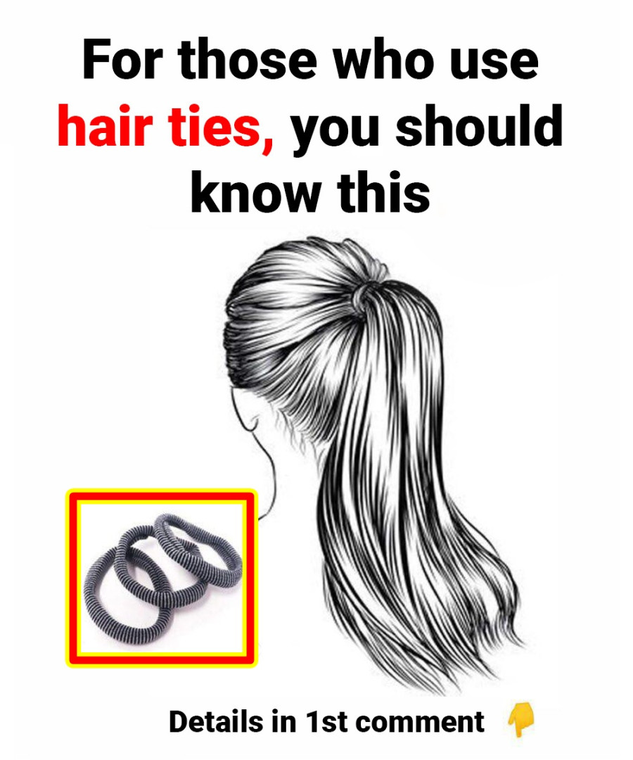 Hair ties can cause …