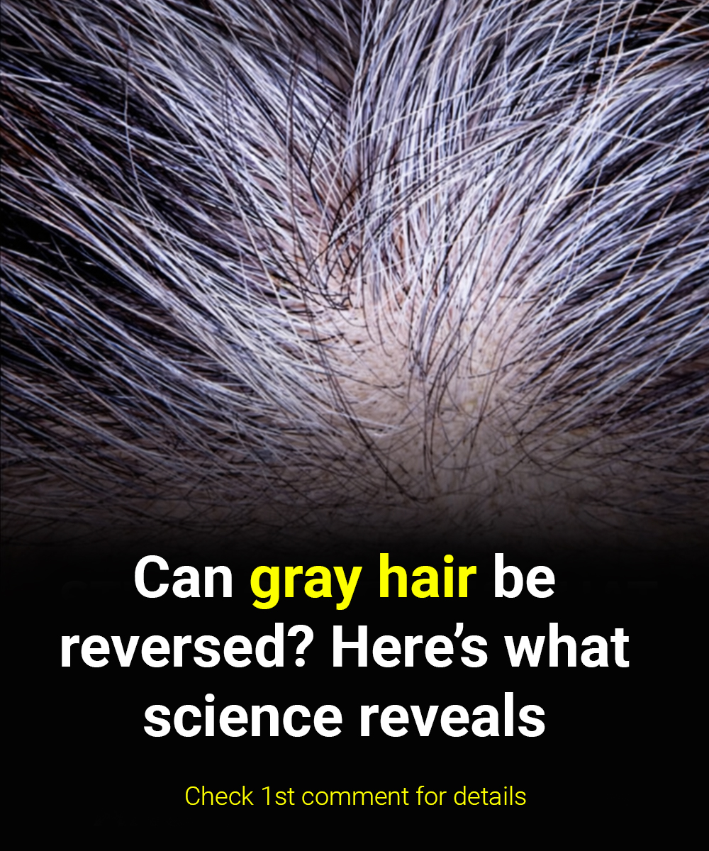 Can gray hair be reversed? Science answers