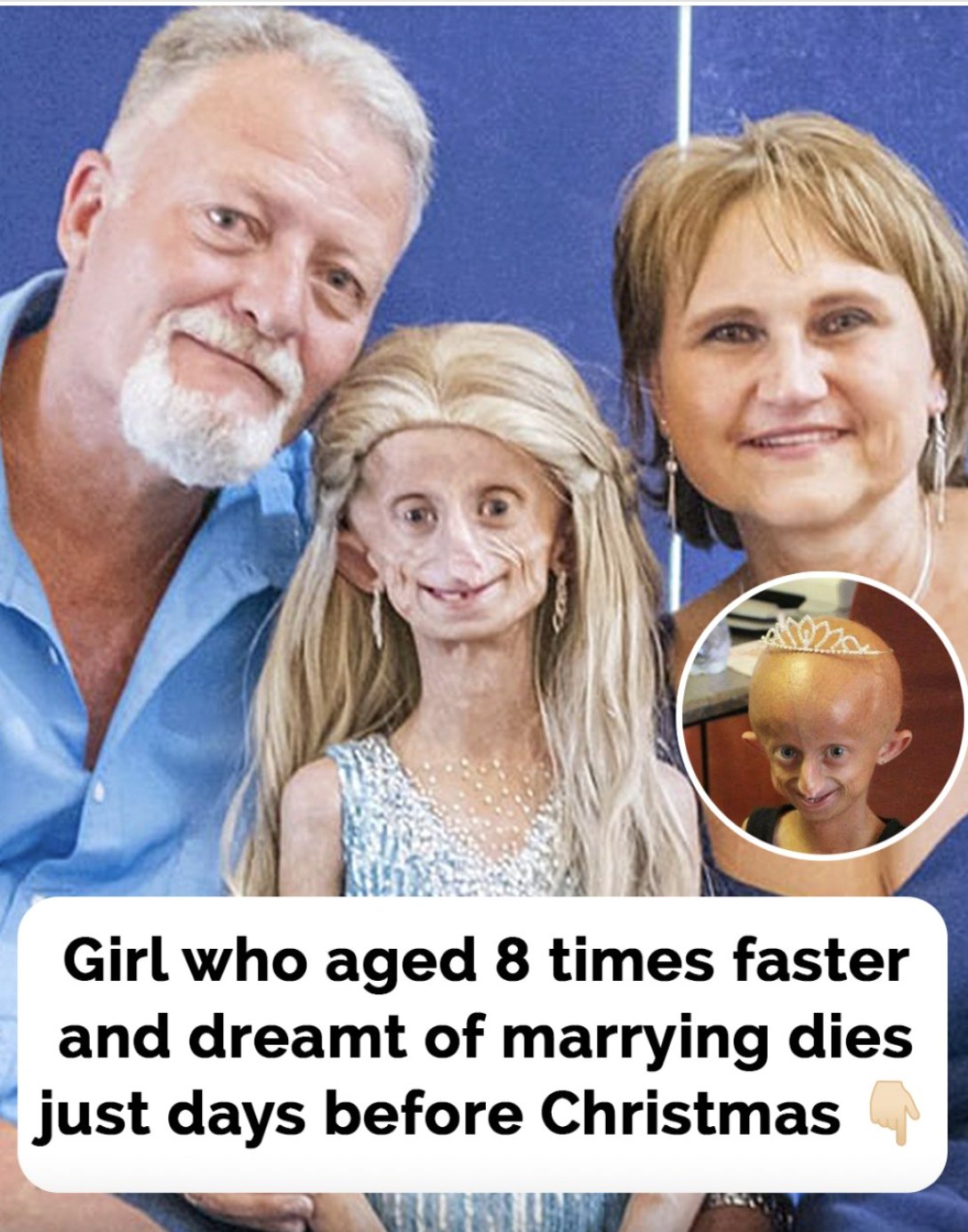 Beandri Booysen: Girl in South Africa with progeria dies