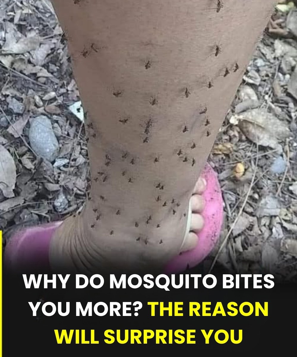 Why mosquitoes always choose you: the scientific explanation few know