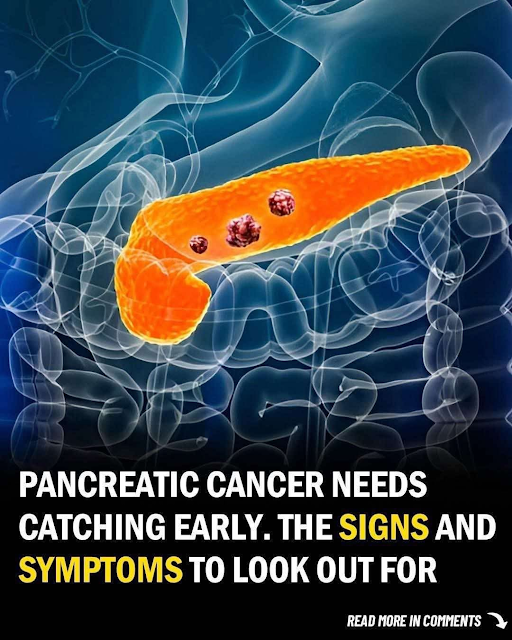 Signs of Pancreatic Cancer You Should Never Ignore
