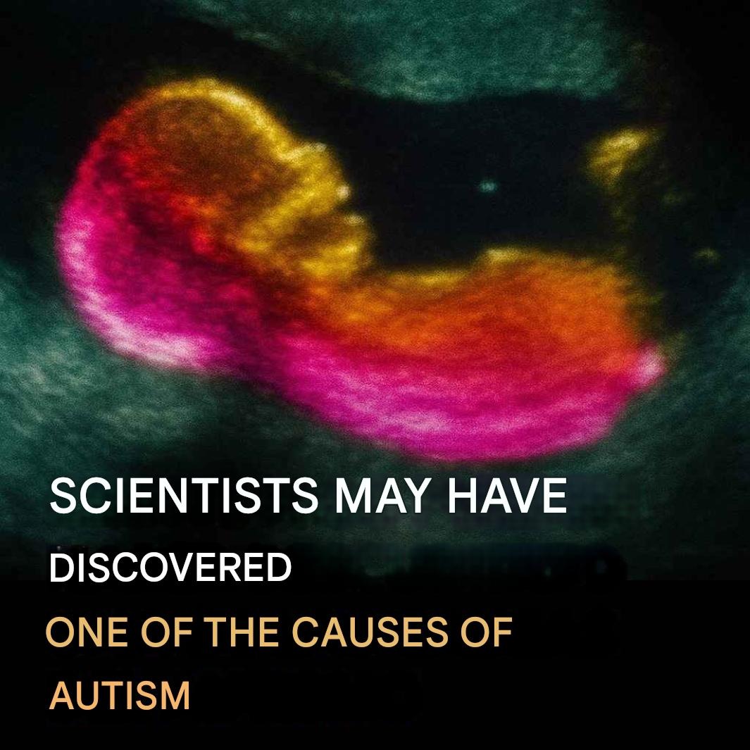 Scientists may have discovered one of the causes of autism.