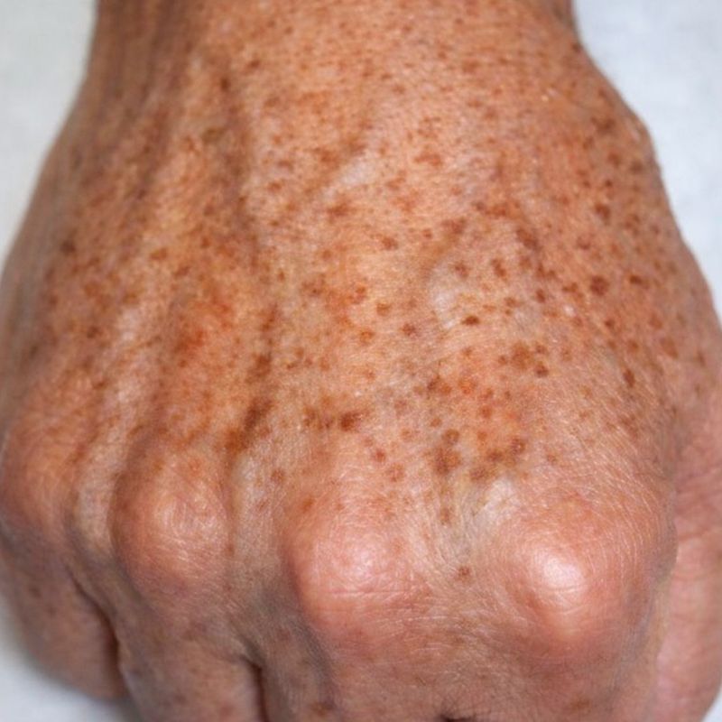 Why do stains form on the hands and how can they be removed?